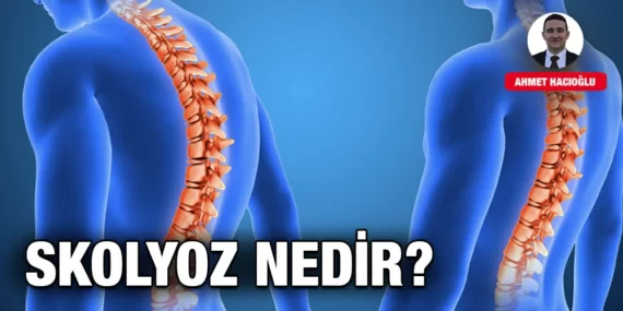 SKOLYOZ NEDİR?