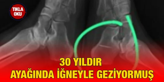 MİDE HASTASI OLUNCA ORTAYA ÇIKTI…