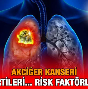 kanser_kriter_haber