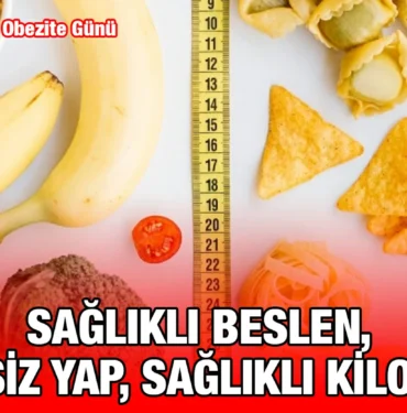 obezite_kriter_haber