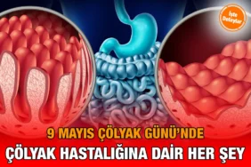 cölyak_kriter_haber
