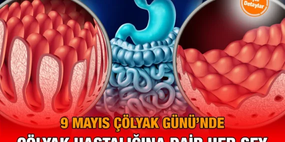 9 Mayıs Çölyak Günü