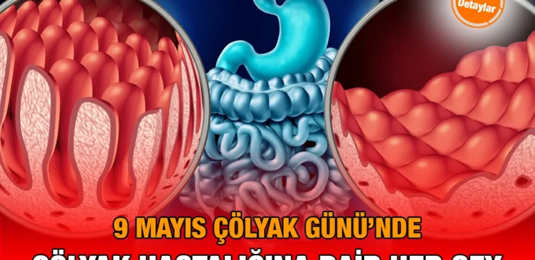 cölyak_kriter_haber