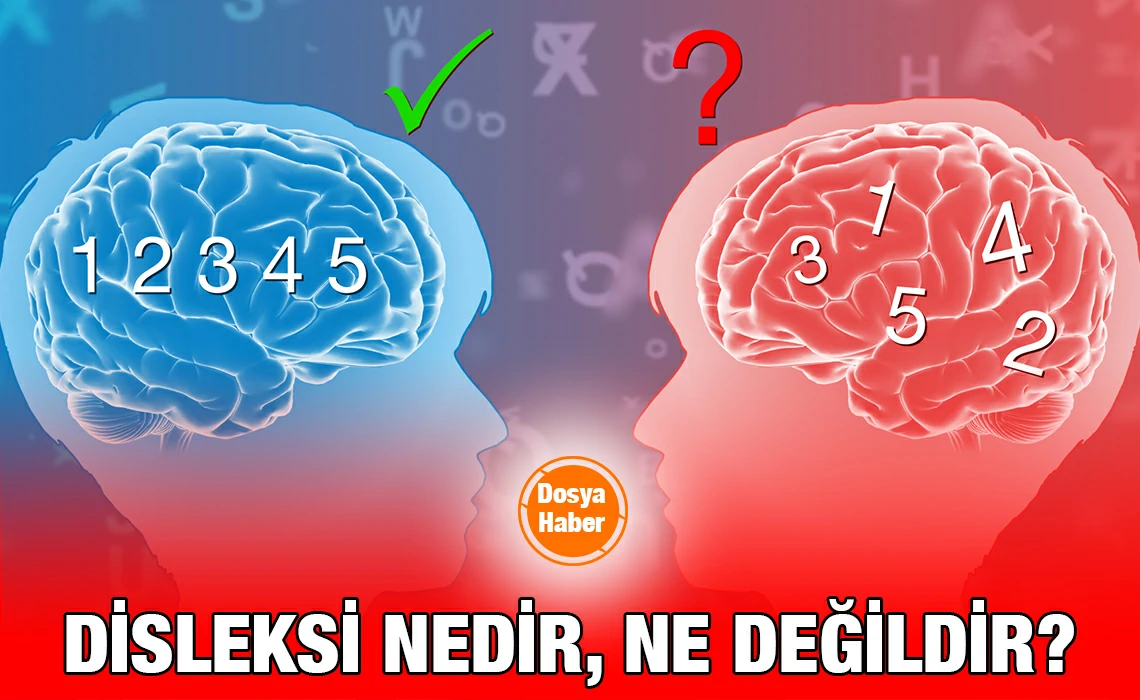 disleksi_kriter_haber