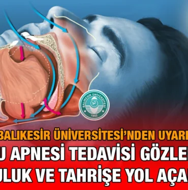 uykuapnesi_kriter_haber