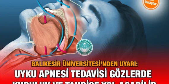 Uyku Apnesi