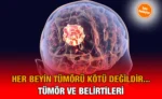 beyin_tumoru_kriter-haber