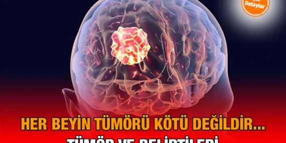 Her beyin tümörü kötü huylu değildir