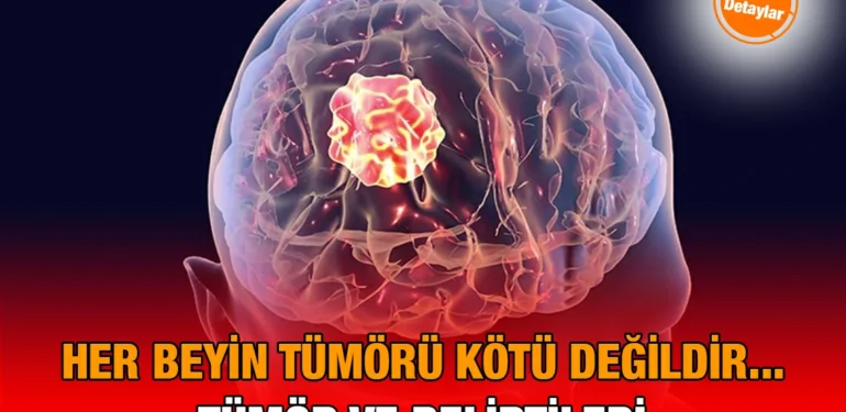 beyin_tumoru_kriter-haber