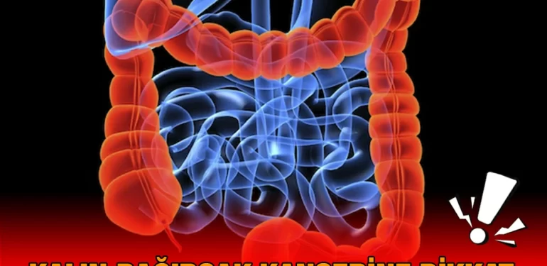 kalin_kanseri_kriter_haber