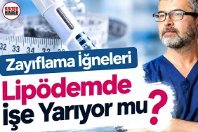 lipodem_kriter_saglik