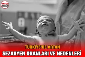sezaryen_kriter_haber